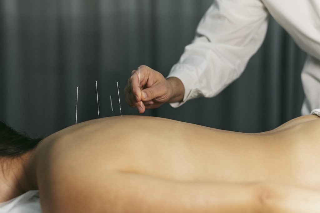 Acupuncturist in Den Haag