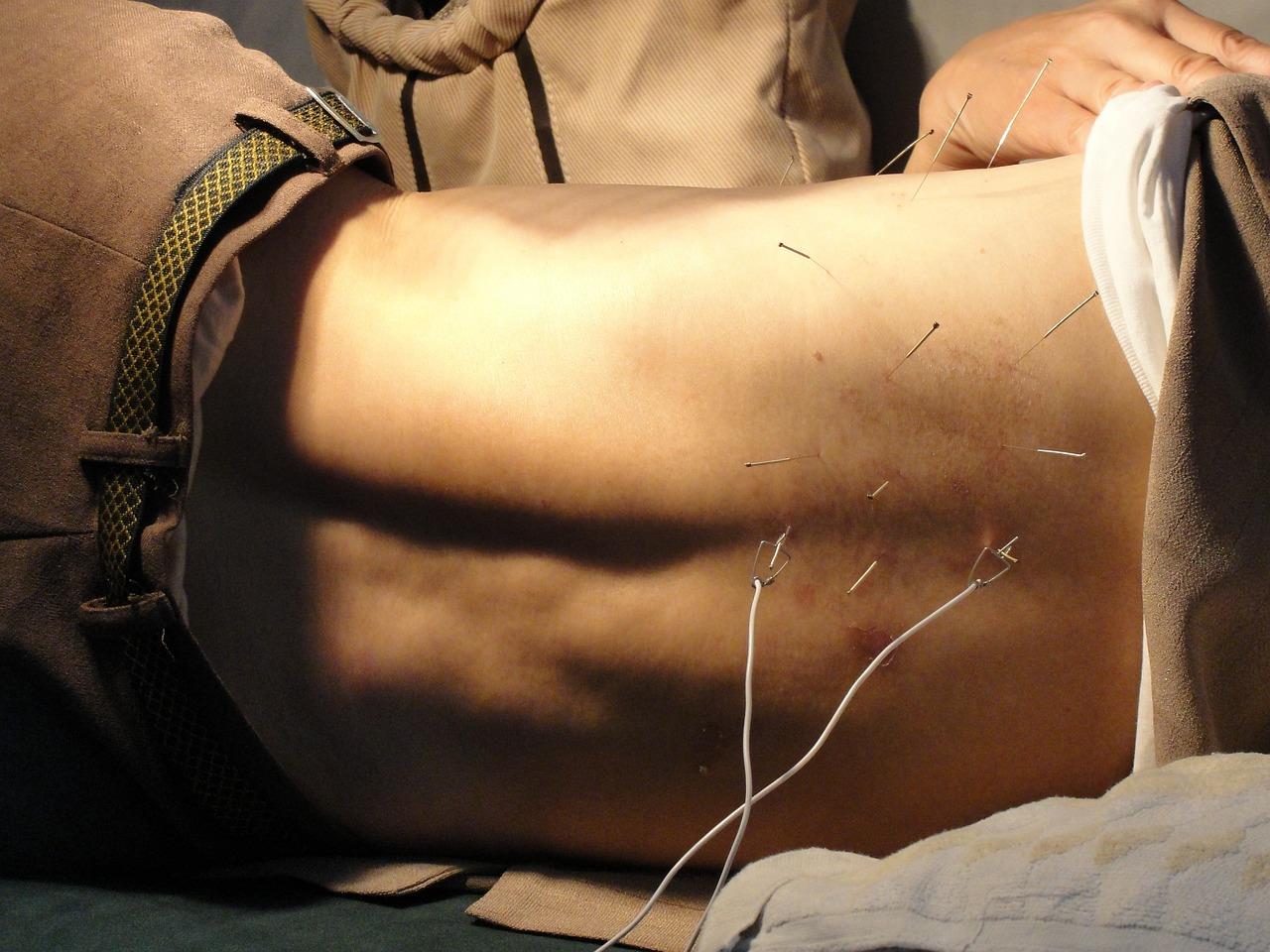 Bedrijven in Den Haag acupuncturist in Den Haag